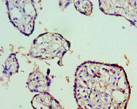 Immunohistochemistry of paraffin-embedded human placenta tissue using STAT5B Antibody at dilution of 1:100Rabbit anti-Human STAT5B Polyclonal Antibody