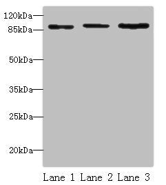 Western blot | All lanes: STAT5B antibody at 16 μg/ml | Lane 1: HepG2 whole cell lysate | Lane 2: K562 whole cell lysate | Lane 3: Hela whole cell lysate | Secondary | Goat polyclonal to rabbit IgG at 1/10000 dilution | Predicted band size: 90 kDa | Observed band size: 90 kDaRabbit anti-Human STAT5B Polyclonal Antibody
