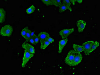 Immunofluorescent analysis of HepG2 cells using STAT5B Antibody at dilution of 1:100 and Alexa Fluor 488-congugated AffiniPure Goat Anti-Rabbit IgG(H+L)Rabbit anti-Human STAT5B Polyclonal Antibody