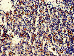 Immunohistochemistry of paraffin-embedded human spleen tissue using STAT5B Antibody at dilution of 1:100Rabbit anti-Human STAT5B Polyclonal Antibody