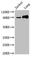 Western Blot  | Positive WB detected in: Jurkat whole cell lysate, Mouse lung tissue  | All lanes: STAT5B antibody at 2.4μg/ml  | Secondary  | Goat polyclonal to rabbit IgG at 1/50000 dilution  | Predicted band size: 90 kDa  | Observed band size: 90 kDaRabbit anti-Human STAT5B Polyclonal Antibody