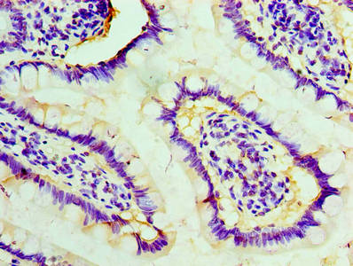 Immunohistochemistry of paraffin-embedded human small intestine tissue using STIP1 Antibody at dilution of 1:100Rabbit anti-Human STIP1 Polyclonal Antibody