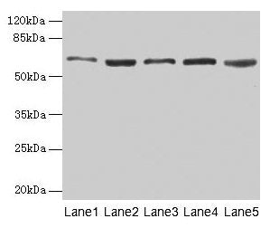 Western blot  | All lanes: STIP1 antibody at 12µg/ml  | Lane 1: Hela whole cell lysate  | Lane 2: HepG2 whole cell lysate  | Lane 3: NIH/3T3 whole cell lysate  | Lane 4: Jurkat whole cell lysate  | Lane 5: Rat gonadal tissue  | Secondary  | Goat polyclonal to rabbit IgG at 1/10000 dilution  | Predicted band size: 63, 69, 60 kDa  | Observed band size: 63 kDaRabbit anti-Human STIP1 Polyclonal Antibody