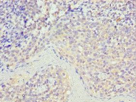Immunohistochemistry of paraffin-embedded human tonsil tissue using STK16 Antibody at dilution of 1:100Rabbit anti-Human STK16 Polyclonal Antibody