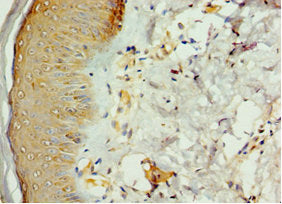 Immunohistochemistry of paraffin-embedded human skin tissue using STK16 Antibody at dilution of 1:100Rabbit anti-Human STK16 Polyclonal Antibody