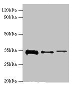 Western blot | All lanes: STK16 antibody at 12μg/ml | Lane 1: A549 whole cell lysate | Lane 2: Mouse brain tissue | Lane 3: A431 whole cell lysate | Secondary | Goat polyclonal to rabbit IgG at 1/10000 dilution | Predicted band size: 35 kDa | Observed band size: 35 kDaRabbit anti-Human STK16 Polyclonal Antibody