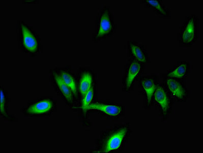 Immunofluorescent analysis of Hela cells using STMN1 Antibody at dilution of 1:100 and Alexa Fluor 488-congugated AffiniPure Goat Anti-Rabbit IgG(H+L)
