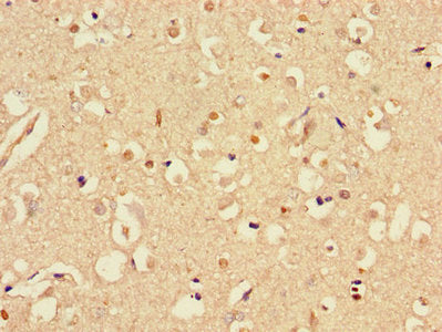 Immunohistochemistry of paraffin-embedded human brain tissue using STMN1 Antibody at dilution of 1:100