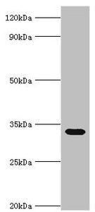 Western blot | All lanes: Erythrocyte band 7 integral membrane protein antibody at 5μg/ml + Mouse liver tissue | Secondary | Goat polyclonal to rabbit IgG at 1/10000 dilution | Predicted band size: 32, 14 kDa | Observed band size: 32 kDaRabbit anti-Human STOM Polyclonal Antibody