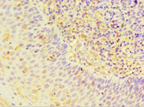 Immunohistochemistry of paraffin-embedded human tonsil tissue using STRN Antibody at dilution of 1:100Rabbit anti-Human STRN Polyclonal Antibody