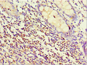 Immunohistochemistry of paraffin-embedded human colon tissue using STRN Antibody at dilution of 1:100Rabbit anti-Human STRN Polyclonal Antibody