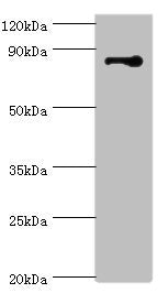 Western blot | All lanes: STRN antibody at 3μg/ml + NIH/3T3 whole cell lysate | Secondary | Goat polyclonal to rabbit IgG at 1/10000 dilution | Predicted band size: 87, 81 kDa | Observed band size: 87 kDaRabbit anti-Human STRN Polyclonal Antibody