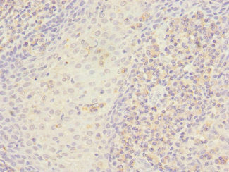 Immunohistochemistry of paraffin-embedded human tonsil tissue using STX7 Antibody at dilution of 1:100Rabbit anti-Human STX7 Polyclonal Antibody