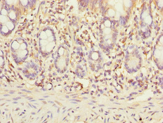Immunohistochemistry of paraffin-embedded human small intestine tissue using STX7 Antibody at dilution of 1:100Rabbit anti-Human STX7 Polyclonal Antibody