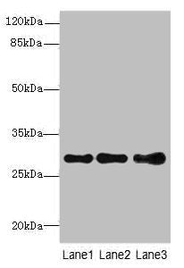 Western blot | All lanes: STX7antibody at 1.39μg/ml | Lane 1: Mouse spleen tissue | Lane 2: Hela whole cell lysate | Lane 3: HepG2 whole cell lysate | Secondary | Goat polyclonal to rabbit IgG at 1/10000 dilution | Predicted band size: 30, 28 kDa | Observed band size: 30 kDaRabbit anti-Human STX7 Polyclonal Antibody