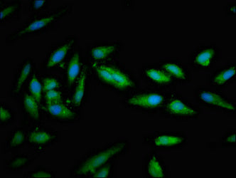 Immunofluorescent analysis of Hela cells using STXBP1 Antibody at dilution of 1:100 and Alexa Fluor 488-congugated AffiniPure Goat Anti-Rabbit IgG(H+L)