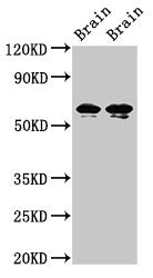 Western Blot | Positive WB detected in: Rat brain tissue, Mouse brain tissue | All lanes: STXBP1 antibody at 2μg/ml | Secondary | Goat polyclonal to rabbit IgG at 1/50000 dilution | Predicted band size: 68, 69 kDa | Observed band size: 68, 69 kDa