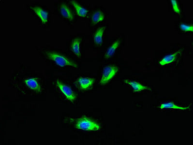 Immunofluorescent analysis of Hela cells using SUCNR1 Antibody at dilution of 1:100 and Alexa Fluor 488-congugated AffiniPure Goat Anti-Rabbit IgG(H+L)Rabbit anti-Human SUCNR1 Polyclonal Antibody