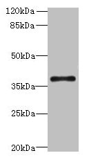 Western blot  | All lanes: SUCNR1 antibody at 6µg/ml + Hela whole cell lysate  | Secondary  | Goat polyclonal to rabbit IgG at 1/10000 dilution  | Predicted band size: 39 kDa  | Observed band size: 39 kDaRabbit anti-Human SUCNR1 Polyclonal Antibody