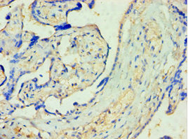 Immunohistochemistry of paraffin-embedded human placenta tissue using SULT1A3 Antibody at dilution of 1:100Rabbit anti-Human SULT1A3 Polyclonal Antibody