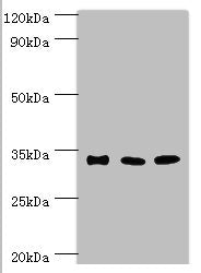 Western blot | All lanes: Sulfotransferase 1A3 antibody at 10μg/ml | Lane 1: A549 whole cell lysate | Lane 2: Mouse liver tissue | Lane 2: Mouse kidney tissue | Secondary | Goat polyclonal to rabbit IgG at 1/10000 dilution | Predicted band size: 35, 23 kDa | Observed band size: 35 kDaRabbit anti-Human SULT1A3 Polyclonal Antibody