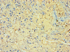 Immunohistochemistry of paraffin-embedded human lung tissue using SULT1A3 Antibody at dilution of 1:100Rabbit anti-Human SULT1A3 Polyclonal Antibody