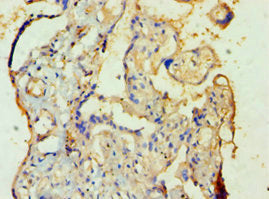 Immunohistochemistry of paraffin-embedded human placenta tissue using SULT1A3 Antibody at dilution of 1:100Rabbit anti-Human SULT1A3 Polyclonal Antibody