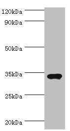 Western blot | All lanes: Sulfotransferase 1A3 antibody at 7μg/ml + A549 whole cell lysate | Secondary | Goat polyclonal to rabbit IgG at 1/10000 dilution | Predicted band size: 35, 23 kDa | Observed band size: 35 kDaRabbit anti-Human SULT1A3 Polyclonal Antibody