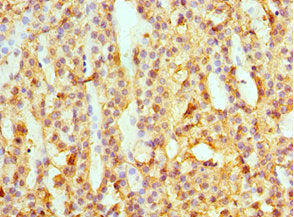 Immunohistochemistry of paraffin-embedded human adrenal gland tissue using SULT2A1 Antibody at dilution of 1:100Rabbit anti-Human SULT2A1 Polyclonal Antibody
