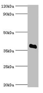 Western blot | All lanes: Bile salt sulfotransferase antibody at 5μg/ml + HepG2 whole cell lysate | Secondary | Goat polyclonal to rabbit IgG at 1/10000 dilution | Predicted band size: 38 kDa | Observed band size: 38 kDaRabbit anti-Human SULT2A1 Polyclonal Antibody