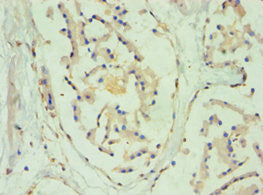 Immunohistochemistry of paraffin-embedded human prostate tissue using SULT2B1 Antibody at dilution of 1:100Rabbit anti-Human SULT2B1 Polyclonal Antibody