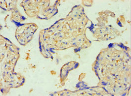 Immunohistochemistry of paraffin-embedded human placenta tissue using SULT2B1 Antibody at dilution of 1:100Rabbit anti-Human SULT2B1 Polyclonal Antibody