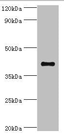 Western blot | All lanes: Sulfotransferase family cytosolic 2B member 1 antibody at 4μg/ml + MCF-7 whole cell lysate | Secondary | Goat polyclonal to rabbit IgG at 1/10000 dilution | Predicted band size: 42, 40 kDa | Observed band size: 42 kDaRabbit anti-Human SULT2B1 Polyclonal Antibody
