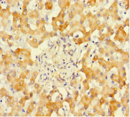 Immunohistochemistry of paraffin-embedded human liver tissue using SUOX Antibody at dilution of 1:100Rabbit anti-Human SUOX Polyclonal Antibody
