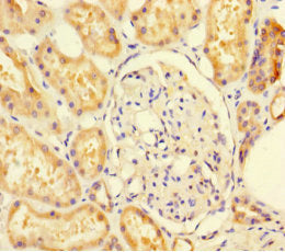 Immunohistochemistry of paraffin-embedded human kidney tissue using SUOX Antibody at dilution of 1:100Rabbit anti-Human SUOX Polyclonal Antibody