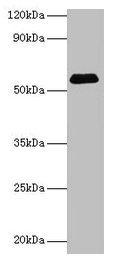 Western blot  | All lanes: SUOX antibody at 2µg/ml + Rat liver tissue  | Secondary  | Goat polyclonal to rabbit IgG at 1/15000 dilution  | Predicted band size: 61 kDa  | Observed band size: 61 kDaRabbit anti-Human SUOX Polyclonal Antibody