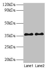 Western blot  | All lanes: SUPT3H antibody at 2µg/ml  | Lane 1: Mouse brain tissue  | Lane 2: Colo320 whole cell lysate  | Secondary  | Goat polyclonal to rabbit IgG at 1/10000 dilution  | Predicted band size: 36, 38 kDa  | Observed band size: 36 kDaRabbit anti-Human SUPT3H Polyclonal Antibody
