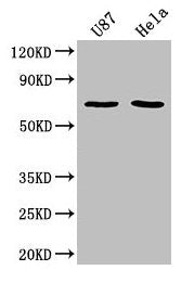 Western Blot | Positive WB detected in: U87 whole cell lysate, Hela whole cell lysate | All lanes: SUSD5 antibody at 1:2000 | Secondary | Goat polyclonal to rabbit IgG at 1/50000 dilution | Predicted band size: 69 kDa | Observed band size: 69 kDaRabbit anti-Human SUSD5 Polyclonal Antibody