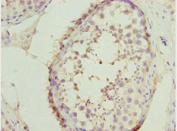 Immunohistochemistry of paraffin-embedded human testis tissue using SYCE1 Antibody at dilution of 1:100Rabbit anti-Human SYCE1 Polyclonal Antibody