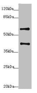 Western blot | All lanes: SYCE1 antibody at 3.38μg/ml + Mouse liver tissue | Secondary | Goat polyclonal to rabbit IgG at 1/10000 dilution | Predicted band size: 40, 33, 22 kDa | Observed band size: 40, 58 kDaRabbit anti-Human SYCE1 Polyclonal Antibody