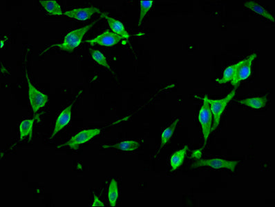 Immunofluorescence staining of NIH/3T3 cells with SYNJ1 Antibody at 1:133, counter-stained with DAPI. The cells were fixed in 4% formaldehyde, permeabilized using 0.2% Triton X-100 and blocked in 10% normal Goat Serum. The cells were then incubated with the antibody overnight at 4°C. The secondary antibody was Alexa Fluor 488-congugated AffiniPure Goat Anti-Rabbit IgG(H+L).Rabbit anti-Human SYNJ1 Polyclonal Antibody