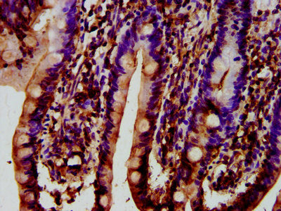 IHC image of SYNJ1 Antibody diluted at 1:400 and staining in paraffin-embedded human small intestine tissue performed on a Leica BondTM system. After dewaxing and hydration, antigen retrieval was mediated by high pressure in a citrate buffer (pH 6.0). Section was blocked with 10% normal goat serum 30min at RT. Then primary antibody (1% BSA) was incubated at 4°C overnight. The primary is detected by a biotinylated secondary antibody and visualized using an HRP conjugated SP system.Rabbit anti-Human SYNJ1 Polyclonal Antibody