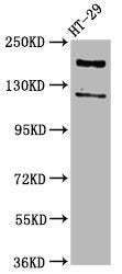 Western Blot  | Positive WB detected in: HT29 whole cell lysate  | All lanes: SYNJ1 antibody at 3.7µg/ml  | Secondary  | Goat polyclonal to rabbit IgG at 1/50000 dilution  | Predicted band size: 174, 145, 144, 59 kDa  | Observed band size: 174 kDaRabbit anti-Human SYNJ1 Polyclonal Antibody