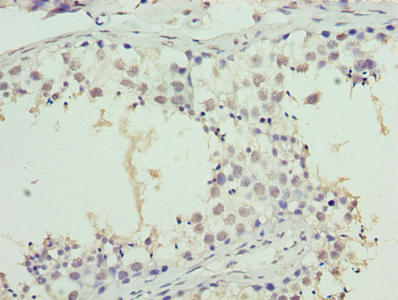Immunohistochemistry of paraffin-embedded human testis tissue using SYNJ2BP Antibody at dilution of 1:100Rabbit anti-Human SYNJ2BP Polyclonal Antibody