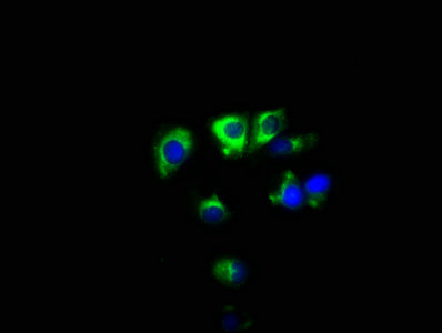 Immunofluorescence staining of MCF-7 cells with the antibody at 1:100, counter-stained with DAPI. The cells were fixed in 4% formaldehyde, permeabilized using 0.2% Triton X-100 and blocked in 10% normal Goat Serum. The cells were then incubated with the antibody overnight at 4°C. The secondary antibody was Alexa Fluor 488-congugated AffiniPure Goat Anti-Rabbit IgG(H+L).Rabbit anti-Human SYNPR Polyclonal Antibody