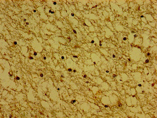 Immunohistochemistry of paraffin-embedded human brain tissue using SYNPR Antibody at dilution of 1:100Rabbit anti-Human SYNPR Polyclonal Antibody