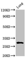 Western Blot  | Positive WB detected in: Rat lung tissue  | All lanes: SYNPR antibody at 3µg/ml  | Secondary  | Goat polyclonal to rabbit IgG at 1/50000 dilution  | Predicted band size: 30, 32 kDa  | Observed band size: 30 kDaRabbit anti-Human SYNPR Polyclonal Antibody