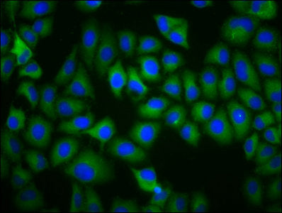 Immunofluorescence staining of Hela cells with TAAR5 Antibody at 1:200, counter-stained with DAPI. The cells were fixed in 4% formaldehyde, permeabilized using 0.2% Triton X-100 and blocked in 10% normal Goat Serum. The cells were then incubated with the antibody overnight at 4°C. The secondary antibody was Alexa Fluor 488-congugated AffiniPure Goat Anti-Rabbit IgG(H+L).Rabbit anti-Human TAAR5 Polyclonal Antibody
