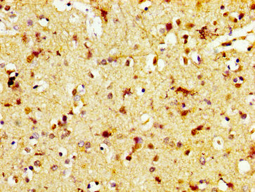 IHC image of TAAR5 Antibody diluted at 1:600 and staining in paraffin-embedded human brain tissue performed on a Leica BondTM system. After dewaxing and hydration, antigen retrieval was mediated by high pressure in a citrate buffer (pH 6.0). Section was blocked with 10% normal goat serum 30min at RT. Then primary antibody (1% BSA) was incubated at 4°C overnight. The primary is detected by a biotinylated secondary antibody and visualized using an HRP conjugated SP system.Rabbit anti-Human TAAR5 Polyclonal Antibody
