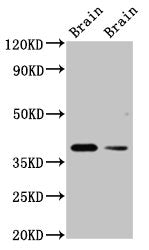 Western Blot | Positive WB detected in: Rat brain tissue, Mouse brain tissue | All lanes: TAAR5 antibody at 3μg/ml | Secondary | Goat polyclonal to rabbit IgG at 1/50000 dilution | Predicted band size: 39 kDa | Observed band size: 39 kDaRabbit anti-Human TAAR5 Polyclonal Antibody